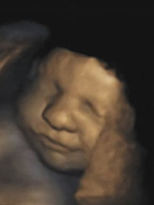 Researchers examined fetal facial movements in ultrasound videos taken in the later stages of pregnancy