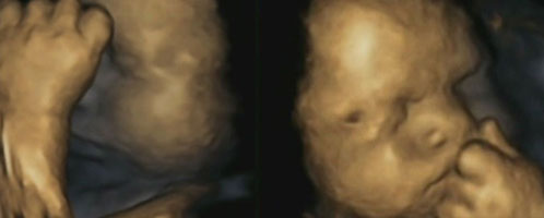 4-d scans of a fetus at 32 weeks gestation displaying left-handed movement; courtesy of Dr Nadja Reissland, Durham University