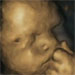Left-handed fetuses could show effects of maternal stress on unborn babies