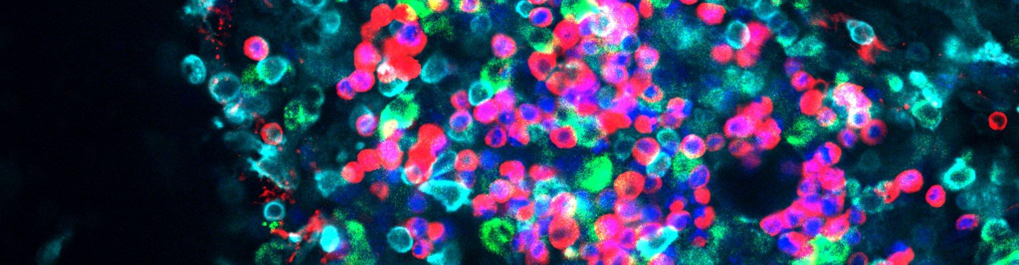 Immune cells within adipose tissue imaged using a confocal microscope