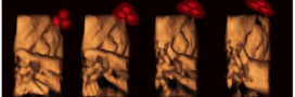 4D ultrasound of a fetus tracking the stimulus