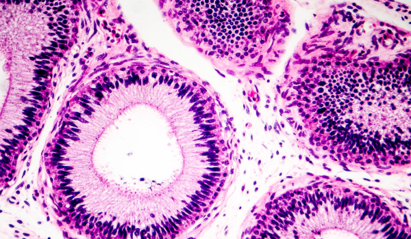 Human tissue under the microscope 