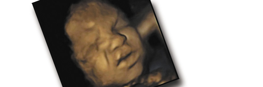 4D scan of a 32 week old foetus showing a "pain" face: courtesy of Durham University