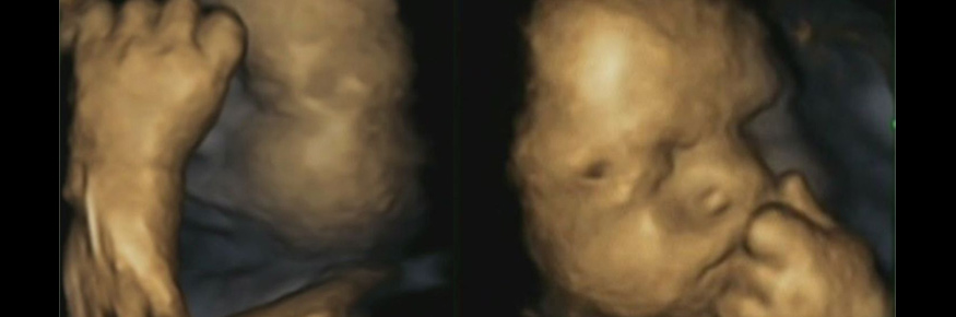 4-d scans of a fetus at 32 weeks gestation displaying left-handed movement; courtesy of Dr Nadja Reissland, Durham University