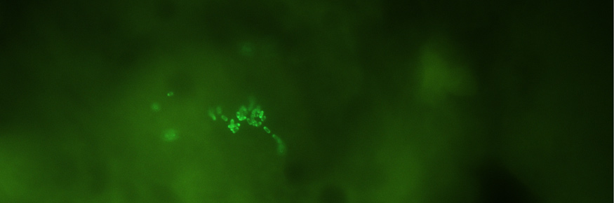 Sandfly gut bacteria transformed to express green fluorescent protein;credit Dr Rod Dillon