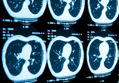 Ct Scan M2